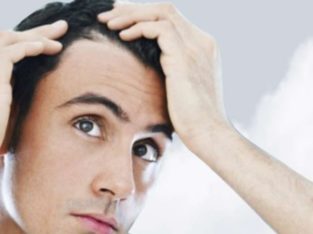 Best Hair Fall Doctor in Ludhiana